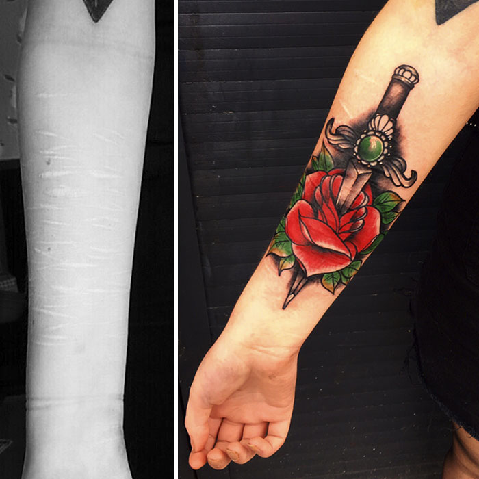 19-Year-Old Wanted To Cover Up Her Self-Harm Scars But All Tattoo Artists Refused To Help. Except One