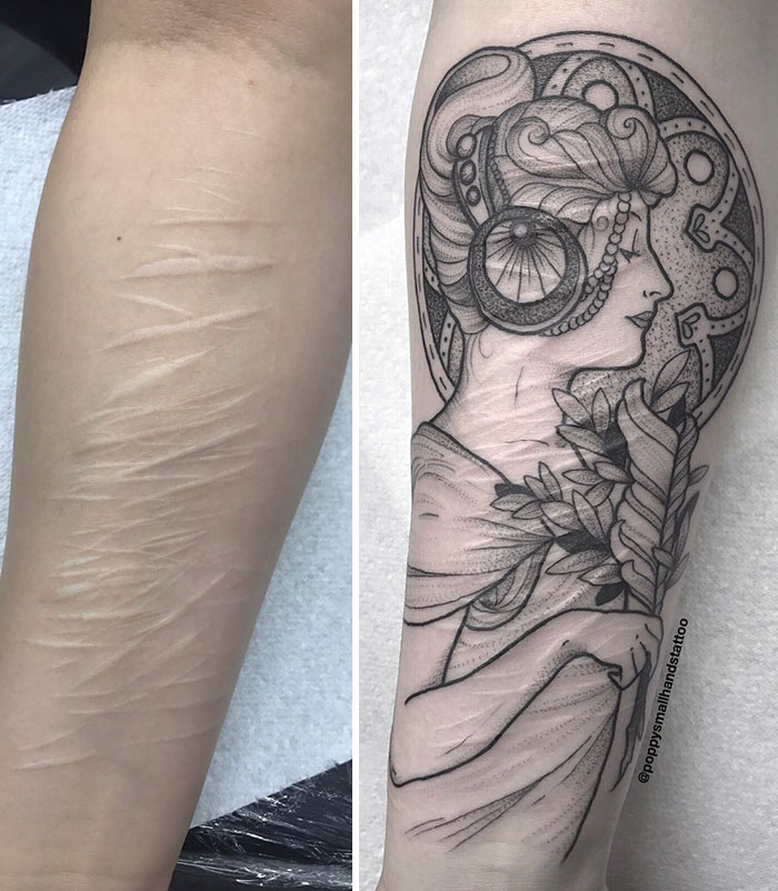 19 . Found A Tattoo Artist To Help Cover Self-Harm Scars | Bored Panda