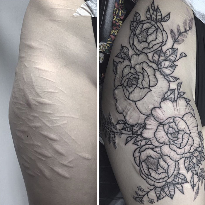 19-Year-Old Wanted To Cover Up Her Self-Harm Scars But All ...