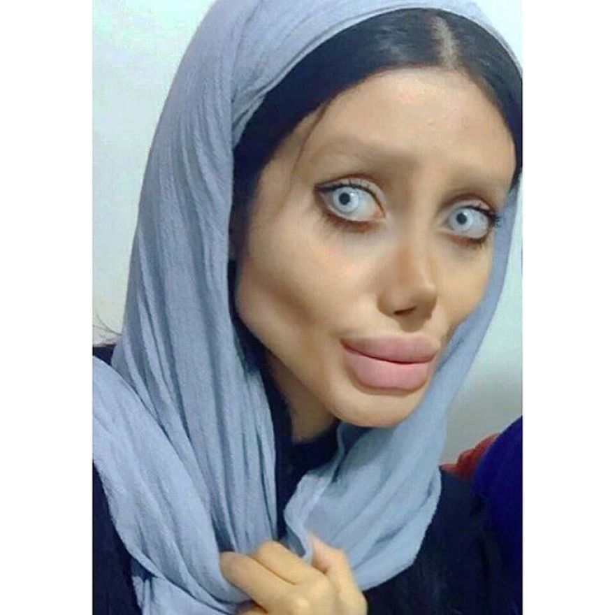 Woman Does 50 Plastic Surgeries To Stay The Same Angelina Jolie And Has A Negative Return On The Internet