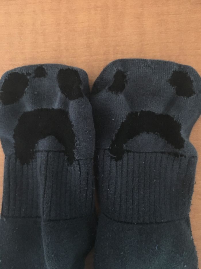 My Socks Have Worn Down So That They Look Like Sad Faces