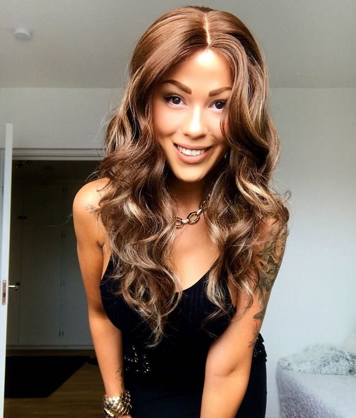 Woman Reveals Her 'Big Secret' She Was Hiding Under The Wig For Years, And Becomes A Model