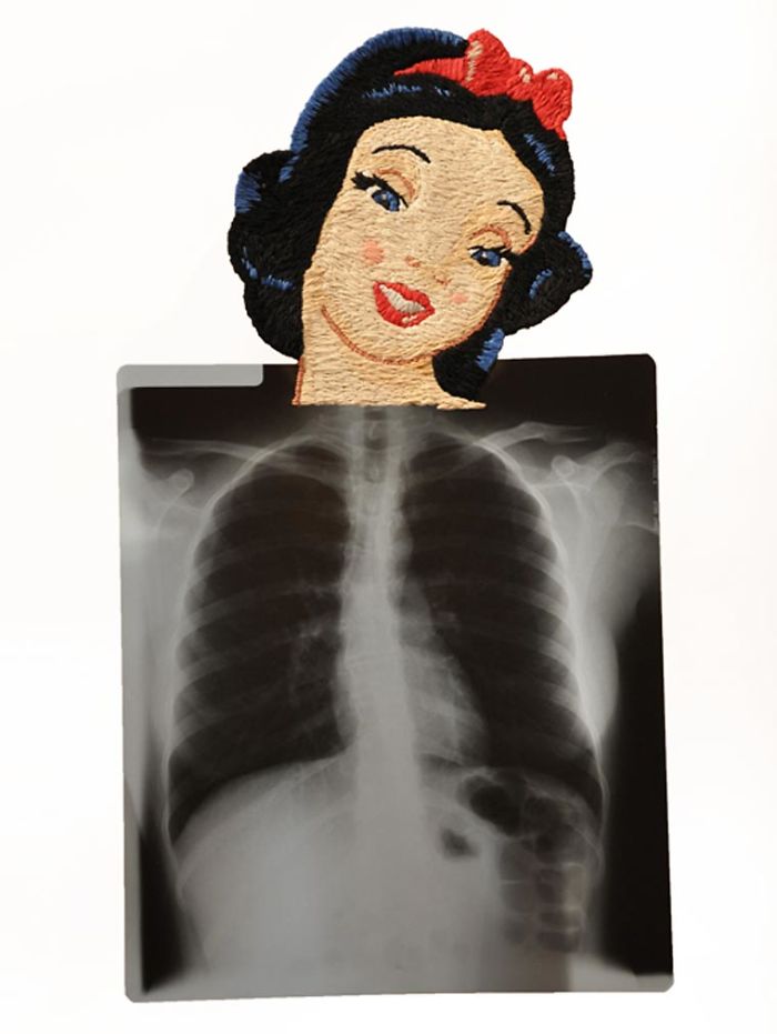 This Artist Creates Incredible Boraddos On Medical X-Rays