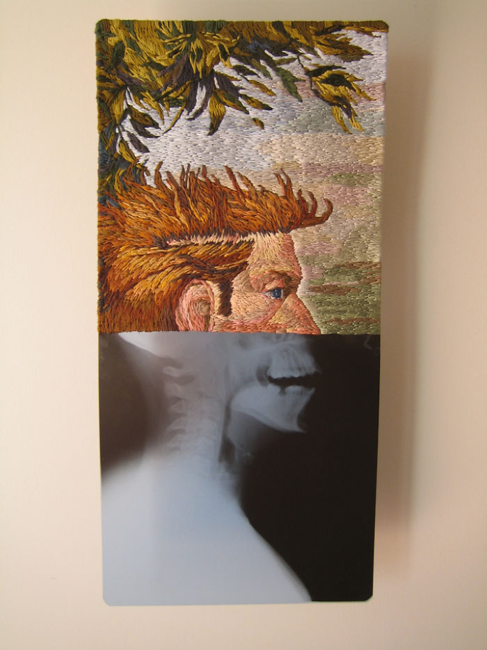 This Artist Creates Incredible Boraddos On Medical X-Rays