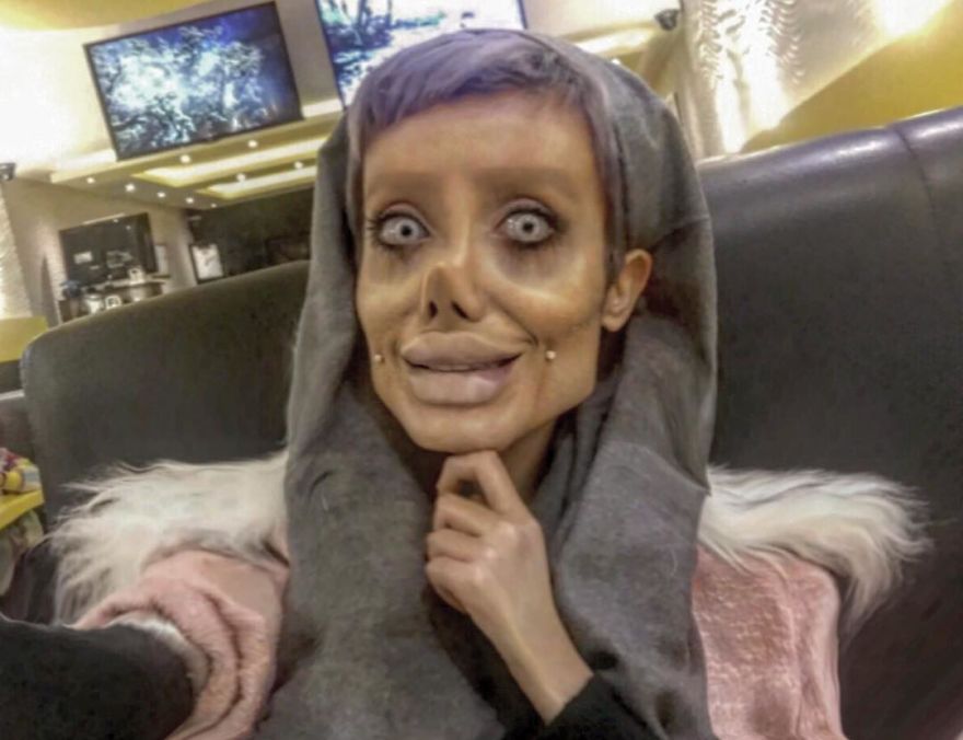 Woman Does 50 Plastic Surgeries To Stay The Same Angelina Jolie And Has A Negative Return On The Internet