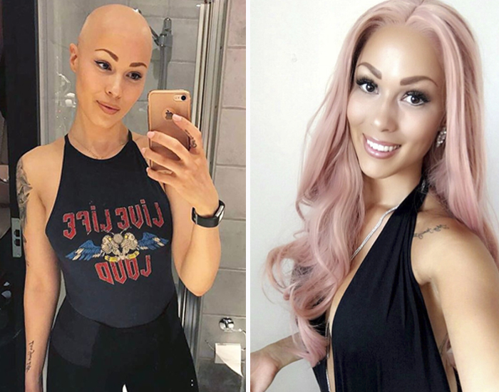 Woman Reveals Her 'Big Secret' She Was Hiding Under The Wig For Years, And Becomes A Model