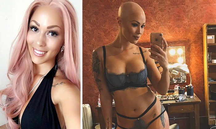 Woman Reveals Her ‘Big Secret’ She Was Hiding Under The Wig For Years, And Becomes A Model
