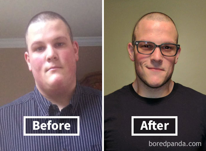 128 Amazing Before After Pics Reveal How Weight Loss Changes Your Face Bored Panda