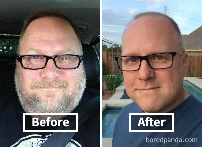 Lost 85.4 Lbs In 7 Months. Face Weight Loss Progress