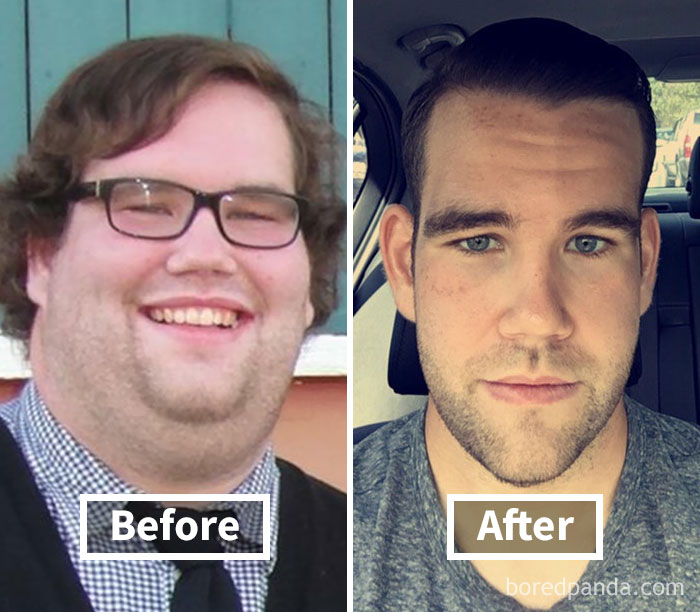 Face Before And After Weight Loss Male