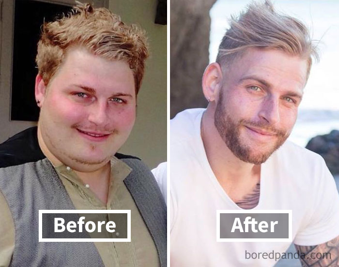 Prima e dopo la perdita di peso