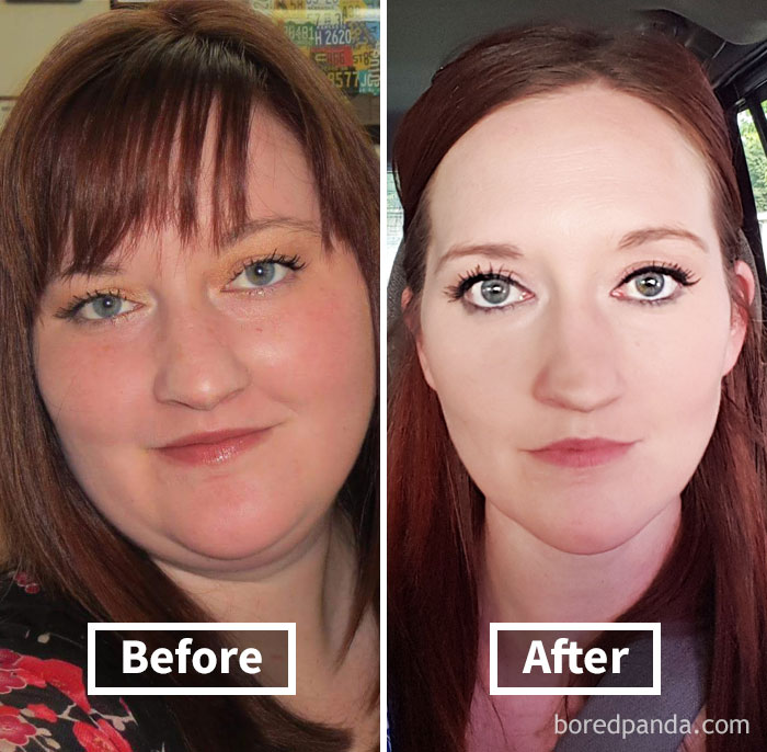 Lost 96 Lbs In 18 Months. Face Change