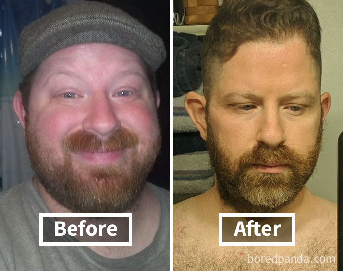 Man with hat before weight loss and after