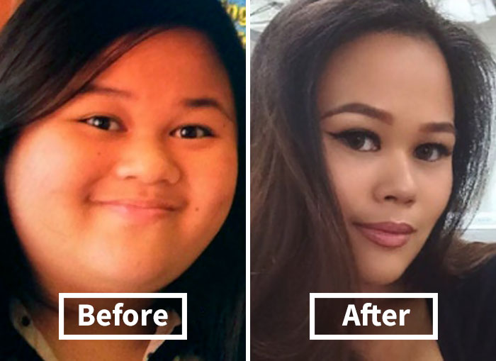 128 Surprising Photos of Face Fat Loss Before and After Weight Loss