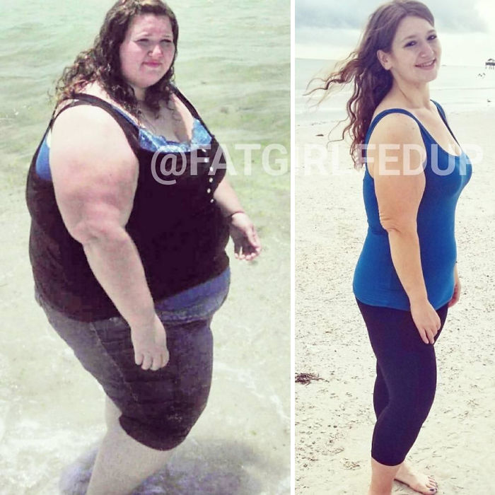 Woman Who Used To Weigh Almost 500lbs Recreates Her Old Photos After Extreme Weight Loss, And Its Hard To Believe Its The Same Person