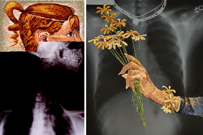Artist Embroiders X-Rays And It’s Beautiful And Creepy At The Same Time