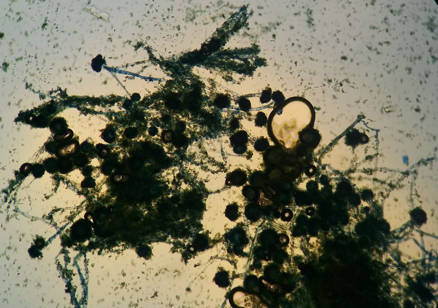 I Find Cosmos Under My Microscope And With Microbial Plate - Microsmos