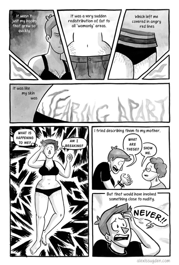 I've Been Making A Weekly Web Comic About The Breast Reduction I Had At 18