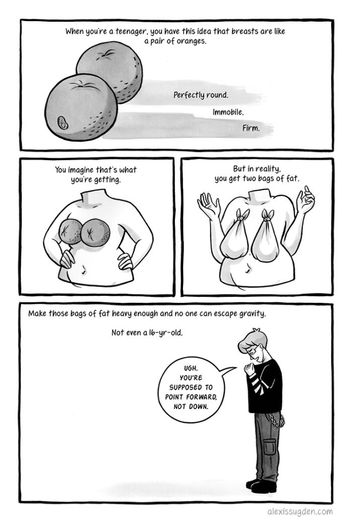 I've Been Making A Weekly Web Comic About The Breast Reduction I Had At 18