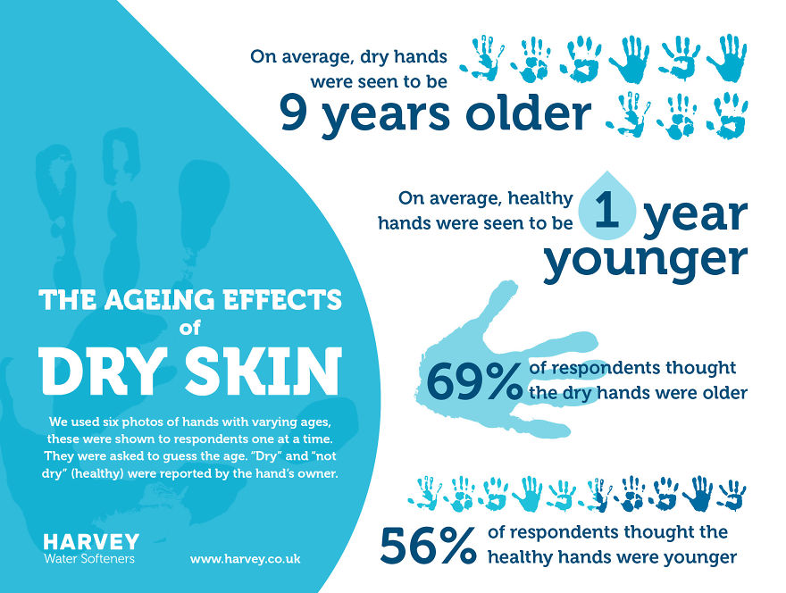 New Research Proves That Having Dry Skin On Your Hands Ages You By 9 Years On Average