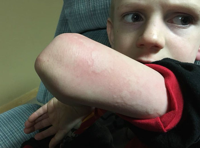 Mom Warns Other Parents About The Unusual Flu Symptom Her Son Experienced