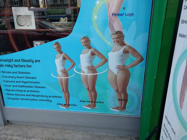 This Is On A Window In London. It's Supposed To Promote Some Weight Loss/diet Thing The Image Of The Woman Was Just Stretched In Photoshop