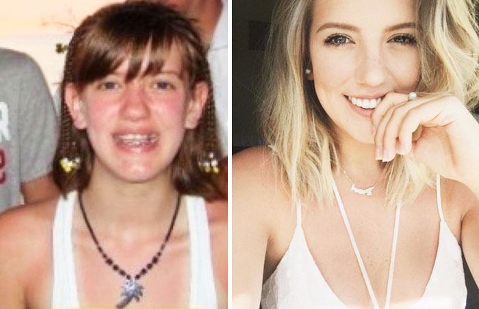 Grew Into My Chin... And My Ears... And Pretty Much My Whole Face (12yo Me Vs. 22yo Me)