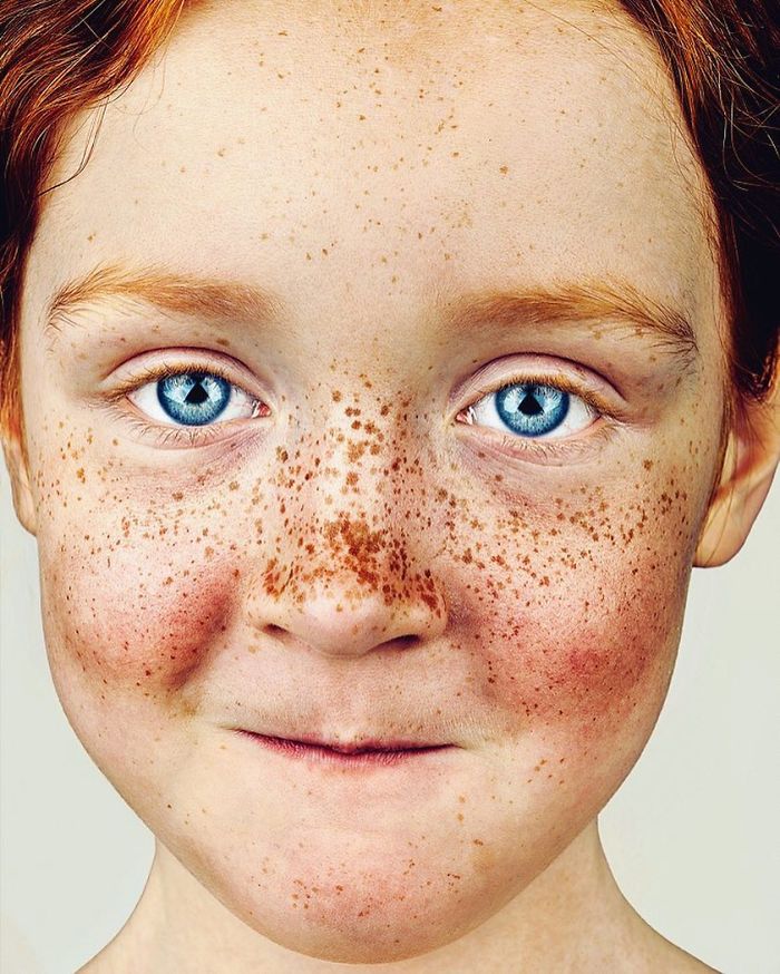 The Beauty Of The Freckles By The Photographer Brock Elbank