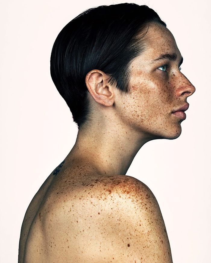 The Beauty Of The Freckles By The Photographer Brock Elbank