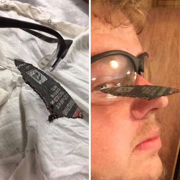 Safety Specs Saved This Guy's Eye From An Exploding Angle Grinder Disc