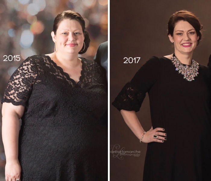 Nutritionist Advised Woman To Do These 3 Simple Things, And She Lost 150 Pounds