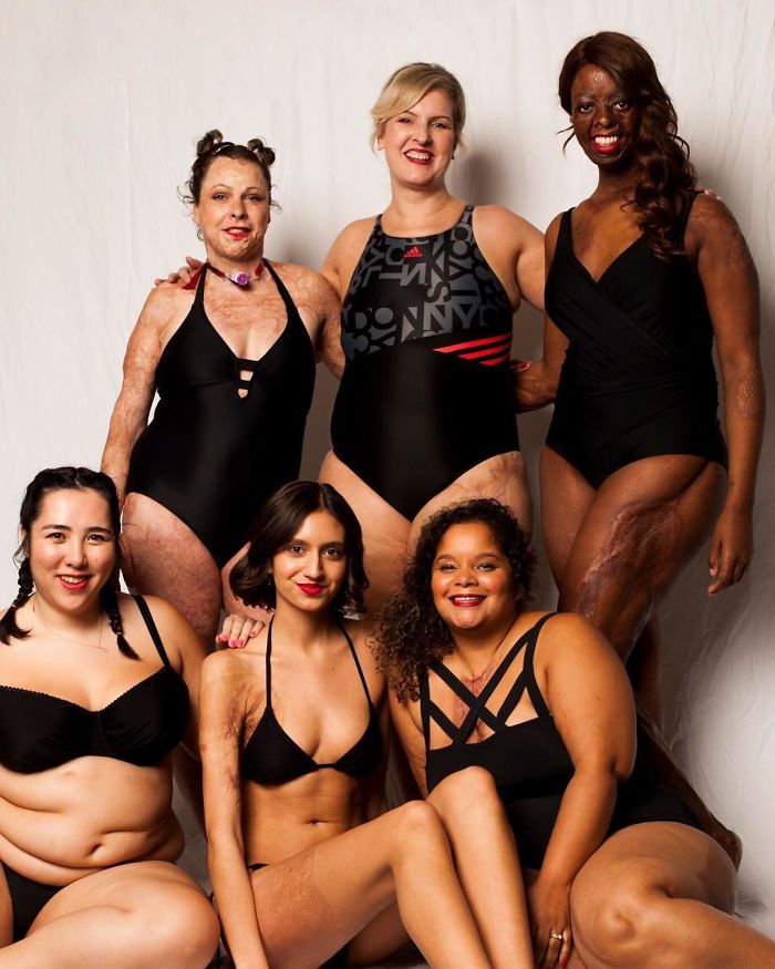 Love Disfigure Swimwear Photo Campaign