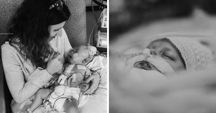 My Son Had Three Open Heart Surgeries Before The Age Of 5, And Here’s How Our Journey Went