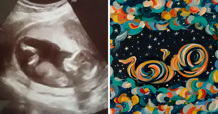 This Artist Transforms Black-And-White Sonograms Into Colorful Paintings