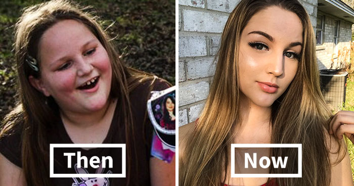 77 Incredible #2012vs2018 Transformations Prove People Can Become Totally Unrecognizable In Just 6 Years