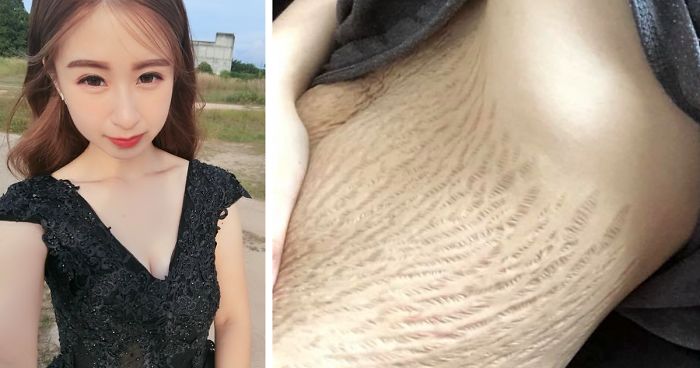 Trolls Tell 23-Year-Old Mom Her ‘Disgusting’ Stretch Marks Make Them Want To Vomit, But She Had The Best Response