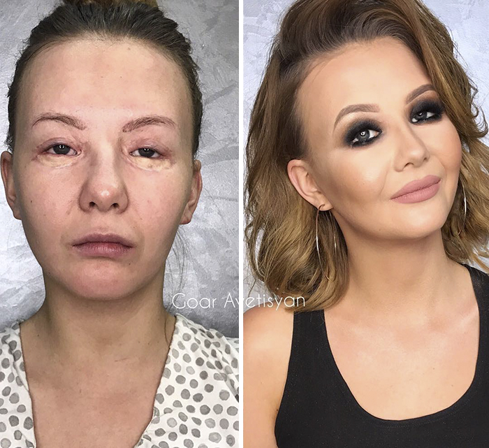  Vlada Had 15 Eye Operations And Really Dreamed To Have A Make Up Transformation