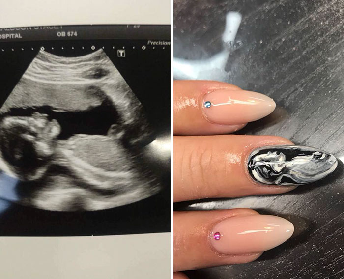 Women Are Getting Ultrasound Scans Painted On Their Nails And People Have  Mixed Feelings About It | Bored Panda