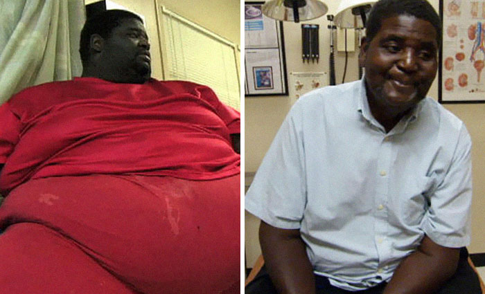 Henry Foots Was 750 Lbs, He Dropped To 250 Lbs