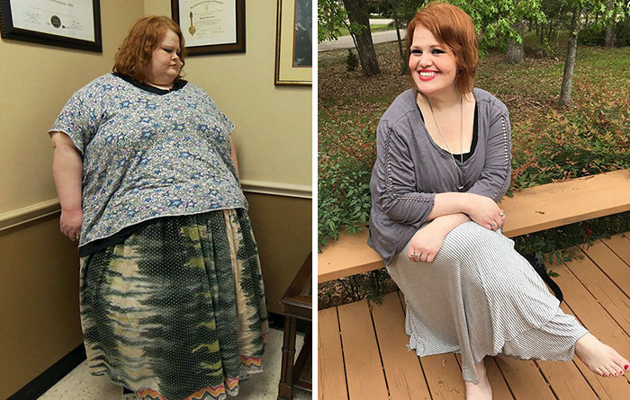 Nikki Webster Was 649 Lbs, She Dropped To 236 Lbs