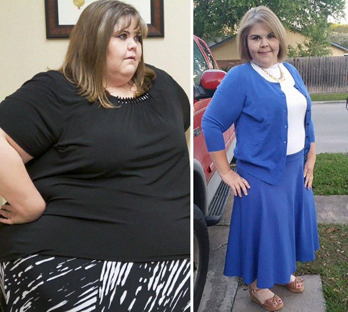 Zsalynn Whitworth Was 600 Lbs, She Dropped To 300 Lbs