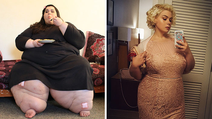 Amber Rachdi Was 660 Lbs, She Dropped To 236 Pounds