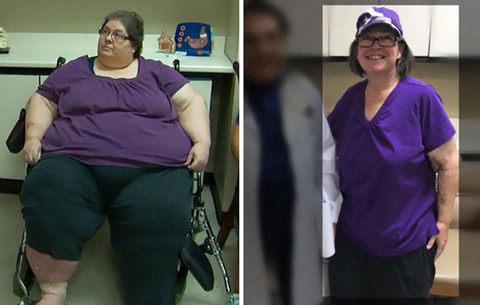Diana Was 601 Lbs She Dropped To 223 Lbs