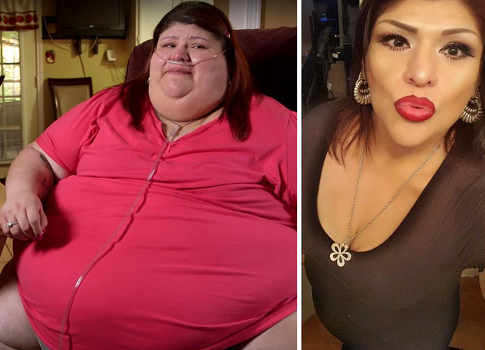 Laura Perez Was 541 Lbs And She Dropped To 380 Lbs