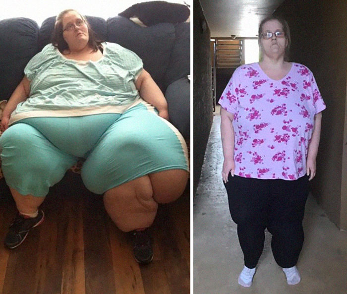 Charity Pierce Was 800 Lbs, She Dropped To 300 Lbs