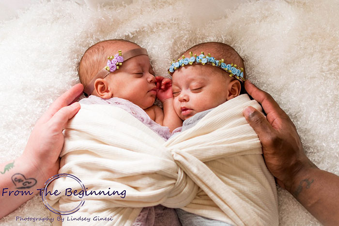 Woman Gives Birth To Another Set Of Rare Identical Twins Against 10-Million-To-One Odds