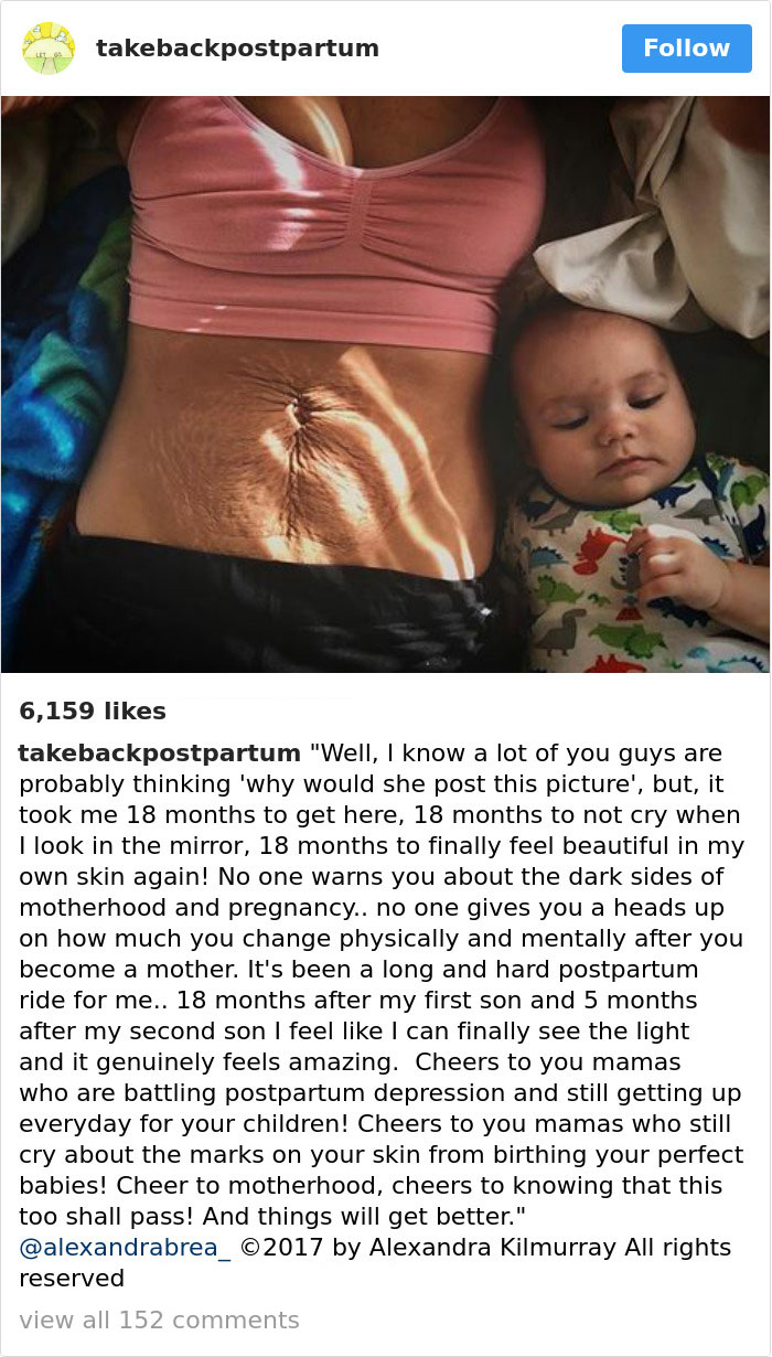 Postpartum Bodies
