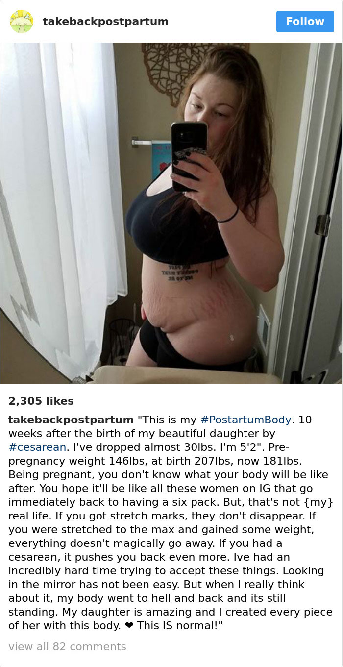 Postpartum Bodies