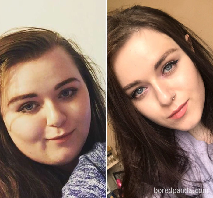 150 Lbs Lost. Face Gains! I’ve Decided To Stop Actively Trying To Lose Weight Now And Focus On Maintaining After Being Told By The Doctor That I’m Healthy All Round! It’s So Nice To Have My Jawline Back Finally