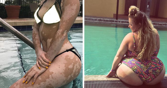 These 40 Women Ignored The Internet Shaming And Proved That Every Body Is Bikini Body